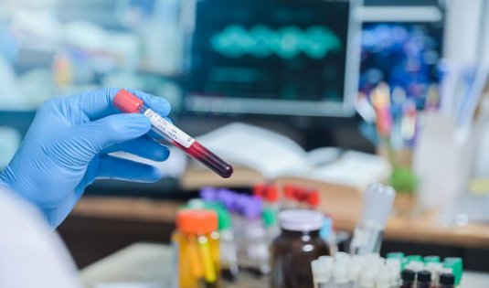 阿根廷女子感染艾滋8年后自然治愈,此案例对攻破艾滋有帮助吗?