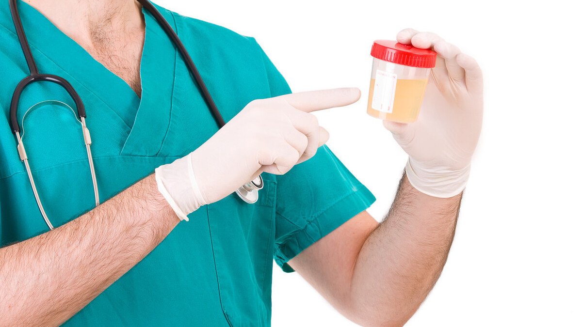 尿蛋白偏高怎么回事?如何治疗?