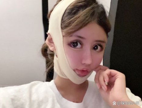 “真人芭比”周楚娜,一张脸价值一辆跑车,现在的颜值有多可怕?