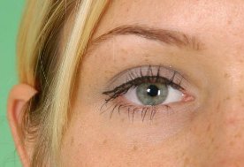 哪些人适合开眼角呢