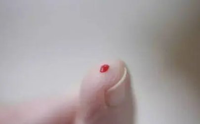 有两网友称在广州街头被人扎针，究竟是什么人对他们扎针的？