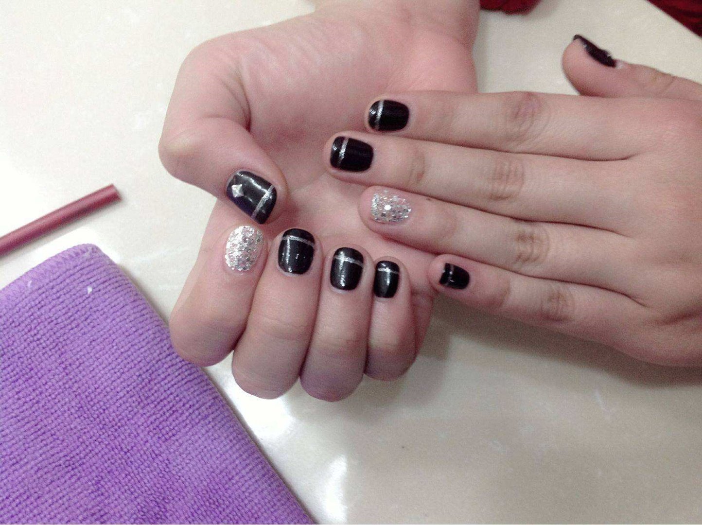 脚指甲为什么会自己脱落?