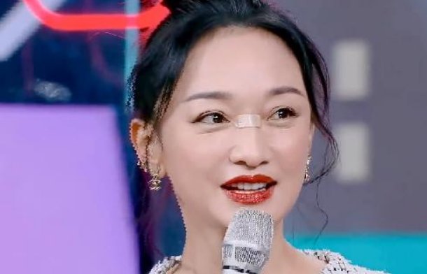 周迅玩手机被砸脸，鼻梁受伤流血，这是咋回事？