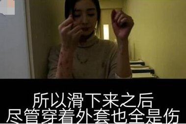 杨幂受伤是怎么回事?