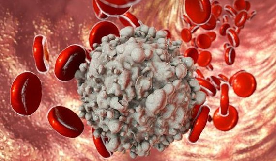 白血病是怎样引起的?