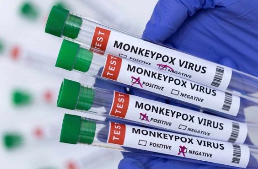世卫组织指出「猴痘病毒已发生人际传播」,怎么预防?