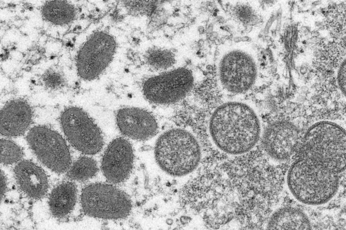 世卫组织指出「猴痘病毒已发生人际传播」,怎么预防?