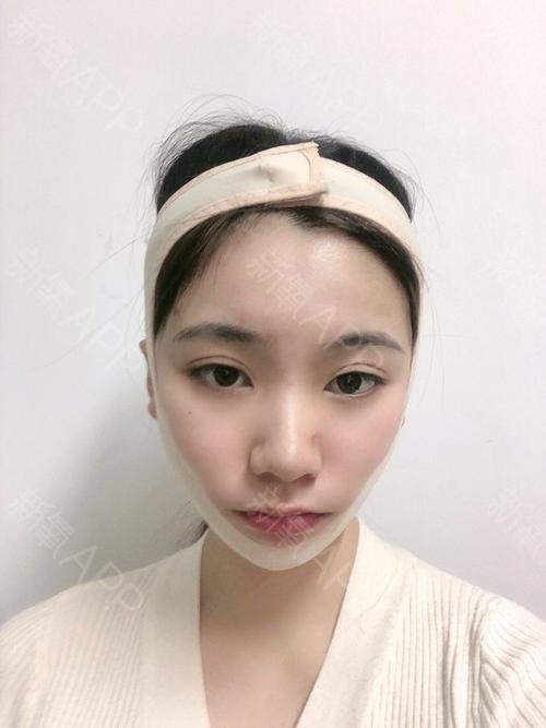 重庆一女子全麻手术整容后发现自己怀孕了!真实原因为何令人胆寒?