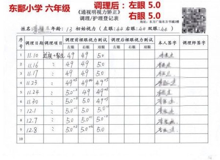 真性近视能治好吗