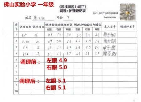 真性近视能治好吗