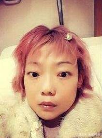 名模伍智恒八年内切割肠胃,全身瘫痪如怪物,如今又怎样了?