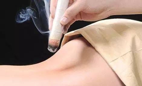 艾灸每天几次?每次多长时间好?