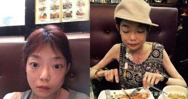 名模伍智恒八年内切割肠胃,全身瘫痪如怪物,如今又怎样了?