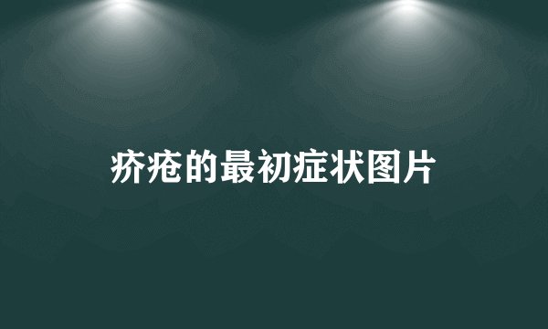 疥疮的最初症状图片