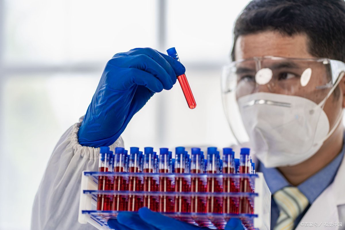 抗原检测龙头股排名