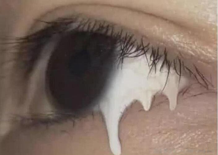 现实中真人阴阳眼图片 人有阴阳眼是真的吗