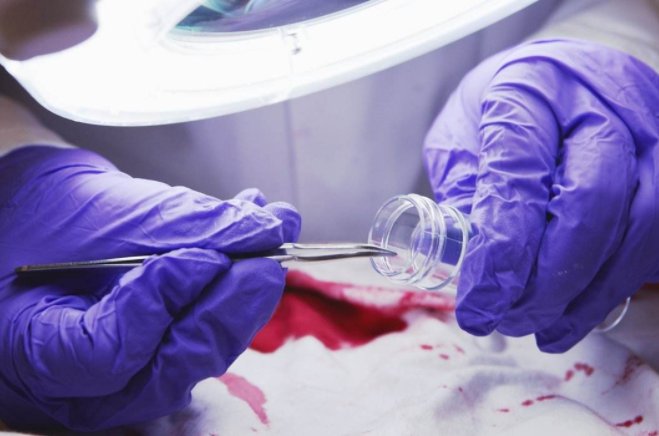 尸体解剖一般多长时间?最长时间是多少天?超过多少天是违法