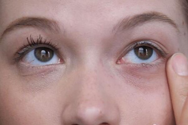 世界上眼睛最大的人是谁？