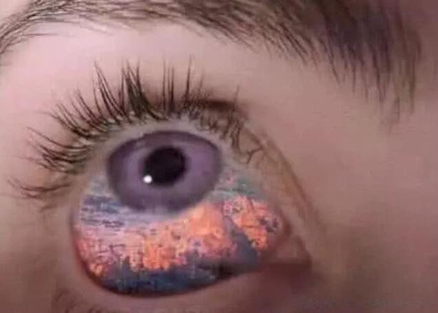 现实中真人阴阳眼图片 人有阴阳眼是真的吗