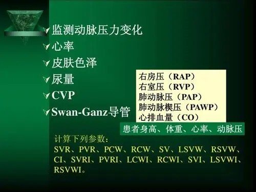 SVI是什么意思？