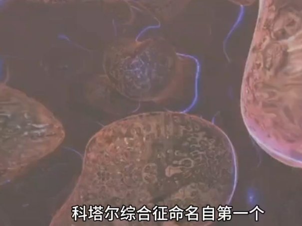 哪种疾病被称作行走的尸体