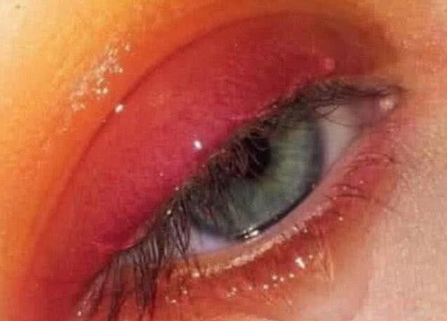 现实中真人阴阳眼图片 人有阴阳眼是真的吗