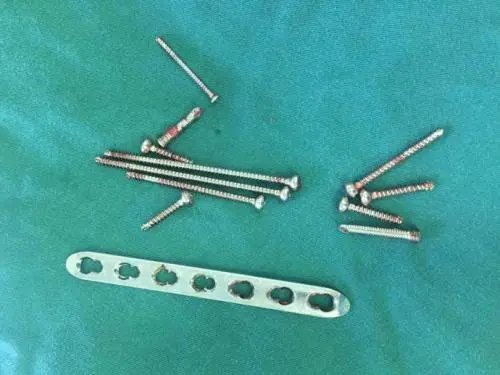 巴基斯坦女子为生男孩用钉子钉头，你如何看待此女子的行为？