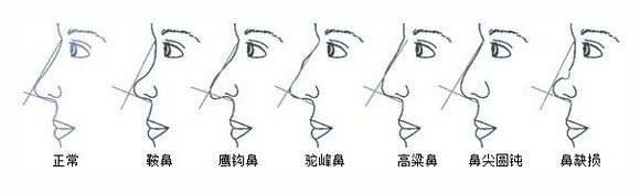 张依依素颜是什么鼻子？