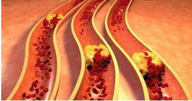 bleeding love的翻译是：什么意思？