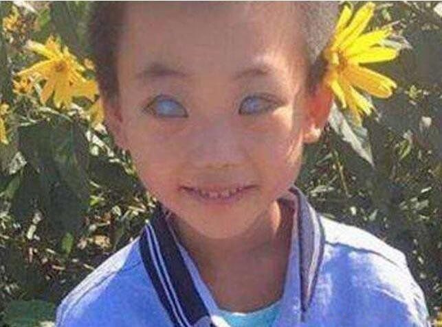 现实中真人阴阳眼图片 人有阴阳眼是真的吗