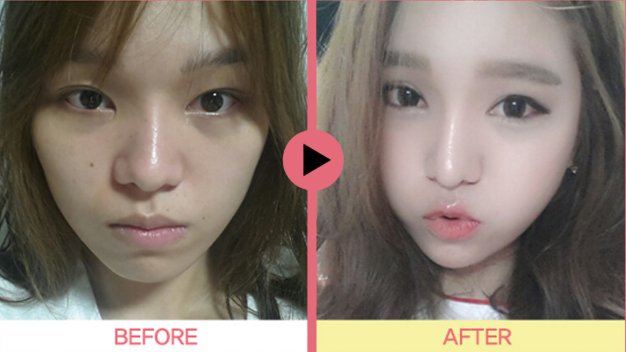 KB韩国整形网的提供什么服务？