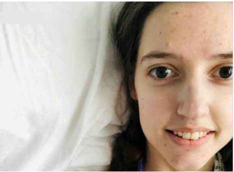 对所有食物过敏英国女子，她是靠什么为生的？