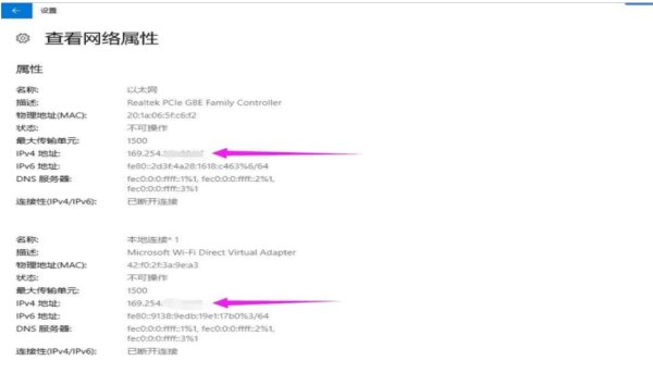 笔记本电脑IP地址怎么看？