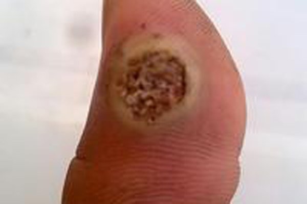 空手指恐怖图片 手指与八目鳗口部PS到一起