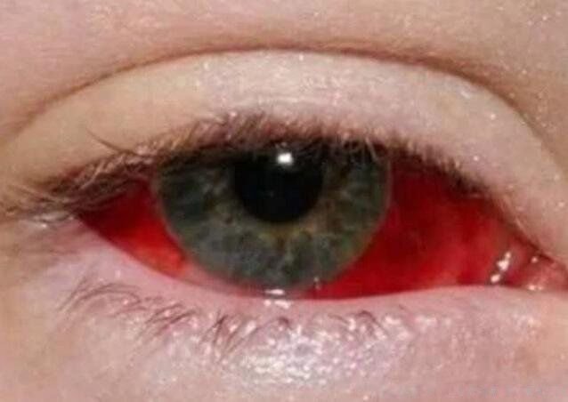 现实中真人阴阳眼图片 人有阴阳眼是真的吗